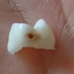 子供のハミガキ困った編~毎日仕上げ磨きは欠かさないのに虫歯になった!
